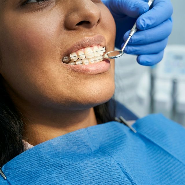 Orthodontic Treatment