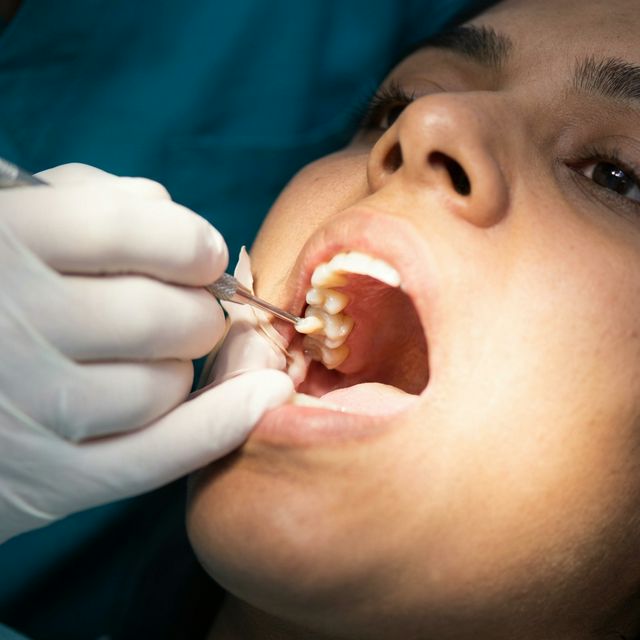 Restorative Dentistry